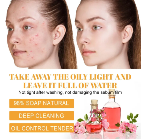 Turmeric Acne-Fade Facial Cleanser